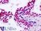 Threonine--tRNA ligase antibody, LS-B9153, Lifespan Biosciences, Immunohistochemistry paraffin image 