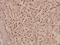 Mediator Complex Subunit 17 antibody, A05399, Boster Biological Technology, Immunohistochemistry frozen image 