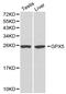 Glutathione Peroxidase 5 antibody, LS-C192347, Lifespan Biosciences, Western Blot image 