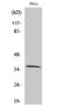 Olfactory Receptor Family 9 Subfamily Q Member 2 antibody, A18881, Boster Biological Technology, Western Blot image 