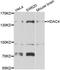 Histone Deacetylase 4 antibody, STJ110260, St John