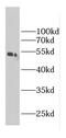 Succinyl-CoA:Glutarate-CoA Transferase antibody, FNab01133, FineTest, Western Blot image 