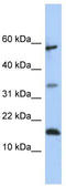 Lipocalin 6 antibody, TA339883, Origene, Western Blot image 