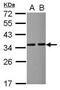 Voltage Dependent Anion Channel 2 antibody, GTX114876, GeneTex, Western Blot image 