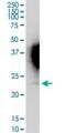 Interferon Alpha 16 antibody, H00003449-D01P, Novus Biologicals, Western Blot image 