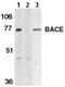 Beta-Secretase 1 antibody, ab2077, Abcam, Western Blot image 