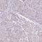 Nuclear VCP Like antibody, HPA028224, Atlas Antibodies, Immunohistochemistry paraffin image 