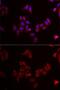Mitogen-Activated Protein Kinase Kinase 5 antibody, GTX55702, GeneTex, Immunofluorescence image 