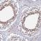 Galactosidase Beta 1 Like antibody, NBP1-81235, Novus Biologicals, Immunohistochemistry frozen image 