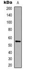Cytochrome P450 Family 21 Subfamily A Member 2 antibody, LS-C368942, Lifespan Biosciences, Western Blot image 
