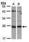 Inosine triphosphate pyrophosphatase antibody, PA5-28483, Invitrogen Antibodies, Western Blot image 