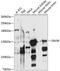 SIN3 Transcription Regulator Family Member B antibody, 13-738, ProSci, Western Blot image 