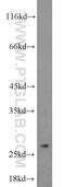Eukaryotic Translation Initiation Factor 4H antibody, 11012-1-AP, Proteintech Group, Western Blot image 
