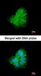 Collagen Type I Alpha 2 Chain antibody, orb73666, Biorbyt, Immunofluorescence image 