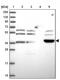 Armadillo Repeat Containing X-Linked 6 antibody, NBP2-30809, Novus Biologicals, Western Blot image 