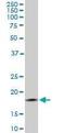 Translocase Of Outer Mitochondrial Membrane 22 antibody, orb95745, Biorbyt, Western Blot image 