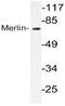 Neurofibromin 2 antibody, AP20757PU-N, Origene, Western Blot image 