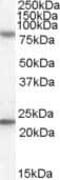 DExH-Box Helicase 58 antibody, PA5-18783, Invitrogen Antibodies, Western Blot image 