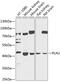 Plasminogen Activator, Urokinase antibody, GTX66413, GeneTex, Western Blot image 