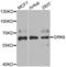 G protein-coupled receptor kinase 6 antibody, LS-C334672, Lifespan Biosciences, Western Blot image 