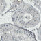 Estrogen Receptor 1 antibody, AMAb90867, Atlas Antibodies, Immunohistochemistry frozen image 