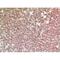 NTCP antibody, LS-C387127, Lifespan Biosciences, Immunohistochemistry paraffin image 