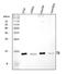 Transthyretin antibody, PB9750, Boster Biological Technology, Western Blot image 