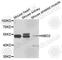 Methyl-CpG Binding Domain Protein 2 antibody, A2241, ABclonal Technology, Western Blot image 