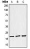 Nucleolar Protein 3 antibody, LS-C353115, Lifespan Biosciences, Western Blot image 