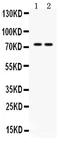 Zinc Finger And BTB Domain Containing 7A antibody, PB9911, Boster Biological Technology, Western Blot image 