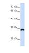 Peroxisomal membrane protein 11A antibody, NBP1-59705, Novus Biologicals, Western Blot image 