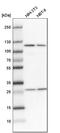 Alanyl-TRNA Synthetase antibody, HPA040870, Atlas Antibodies, Western Blot image 