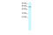 Forkhead Box N3 antibody, 27-724, ProSci, Western Blot image 