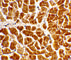 C-X3-C Motif Chemokine Receptor 1 antibody, 2093, ProSci, Immunohistochemistry paraffin image 