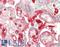 Complement Factor H antibody, LS-B14622, Lifespan Biosciences, Immunohistochemistry paraffin image 
