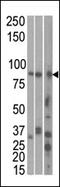 Microtubule Affinity Regulating Kinase 1 antibody, AP13783PU-N, Origene, Western Blot image 