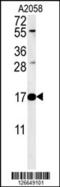 Ribonuclease kappa antibody, 61-859, ProSci, Western Blot image 