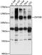 Zinc Finger Protein 598 antibody, LS-C750515, Lifespan Biosciences, Western Blot image 