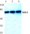 Anosmin 1 antibody, A06684-2, Boster Biological Technology, Western Blot image 