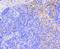 Actin Related Protein 2/3 Complex Subunit 5 antibody, NBP2-67350, Novus Biologicals, Immunohistochemistry paraffin image 