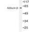 Adducin 2 antibody, LS-C177037, Lifespan Biosciences, Western Blot image 