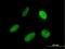 Signal Recognition Particle 68 antibody, H00006730-M03, Novus Biologicals, Immunocytochemistry image 