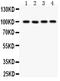 Transient Receptor Potential Cation Channel Subfamily C Member 7 antibody, PB9272, Boster Biological Technology, Western Blot image 