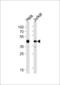 Actin Related Protein 2 antibody, 62-308, ProSci, Western Blot image 