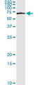 Frizzled Class Receptor 5 antibody, LS-C198504, Lifespan Biosciences, Immunoprecipitation image 