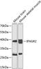 IFN-gamma-R2 antibody, 23-026, ProSci, Western Blot image 