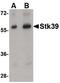 STE20/SPS1-related proline-alanine-rich protein kinase antibody, PA5-20628, Invitrogen Antibodies, Western Blot image 