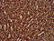 Peptidylprolyl Isomerase E antibody, LS-C671684, Lifespan Biosciences, Immunohistochemistry paraffin image 