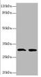 Interleukin 1 Beta antibody, orb241339, Biorbyt, Western Blot image 