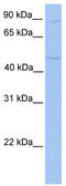 Transmembrane And Tetratricopeptide Repeat Containing 2 antibody, TA330978, Origene, Western Blot image 